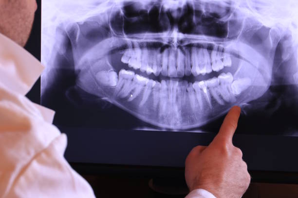 Best Chipped Tooth Repair Near Me  in Providence Village, TX